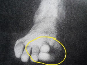 Ankichi's unique forming of the toe-tip for "ashisaki-geri".